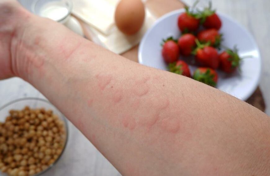 Alergie a potravinová nesnášenlivost